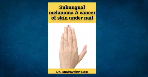 subungual-melanoma-a-cancer-of-skin-under-nail-by-dr-bhairavsinh-raol